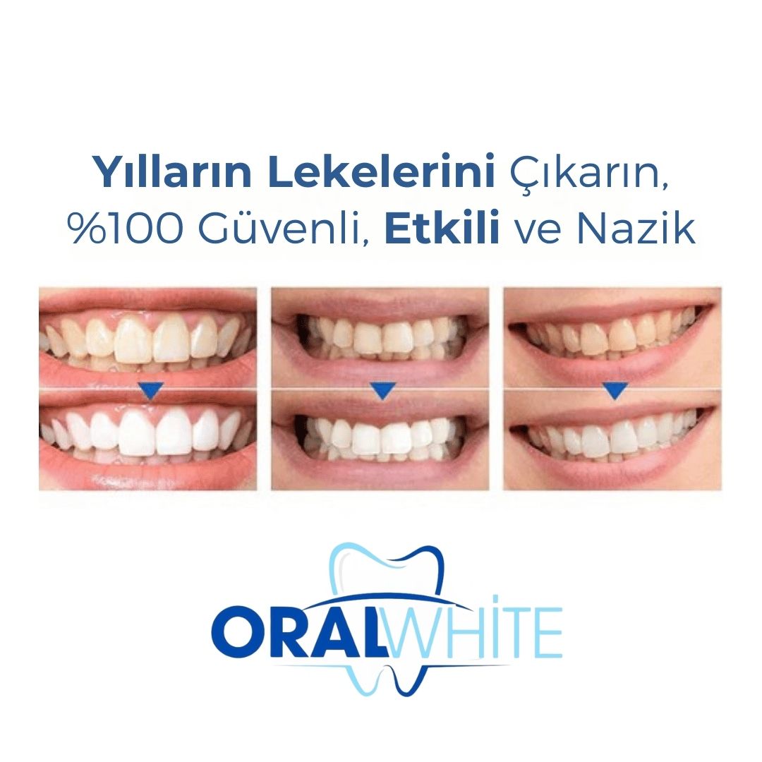 Oral White® Diş Beyazlatıcı Kalem