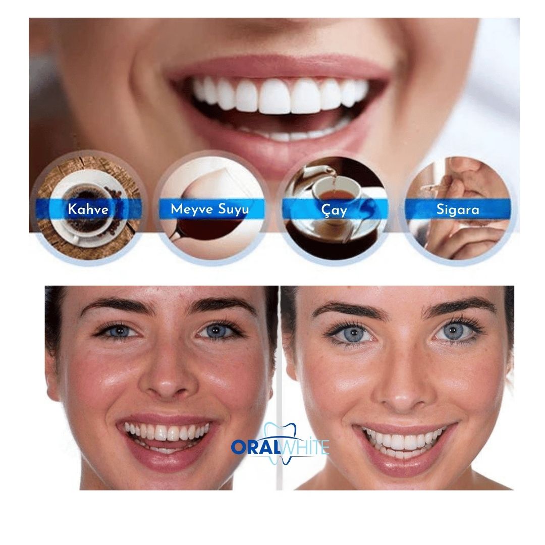 Oral White® Diş Beyazlatıcı Kalem