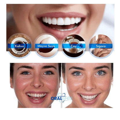 Oral White® Diş Beyazlatıcı Kalem